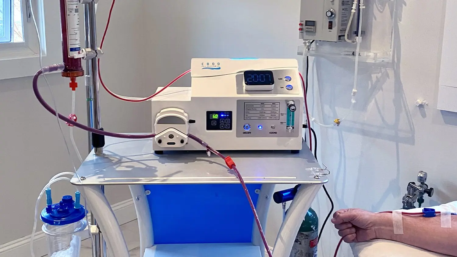 EBOO Machine